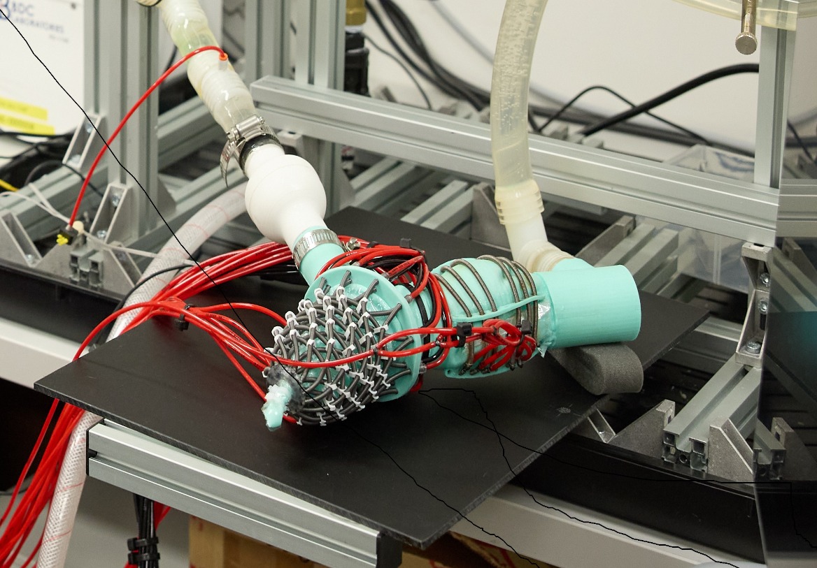Pioneering Soft Robotics in Medicine