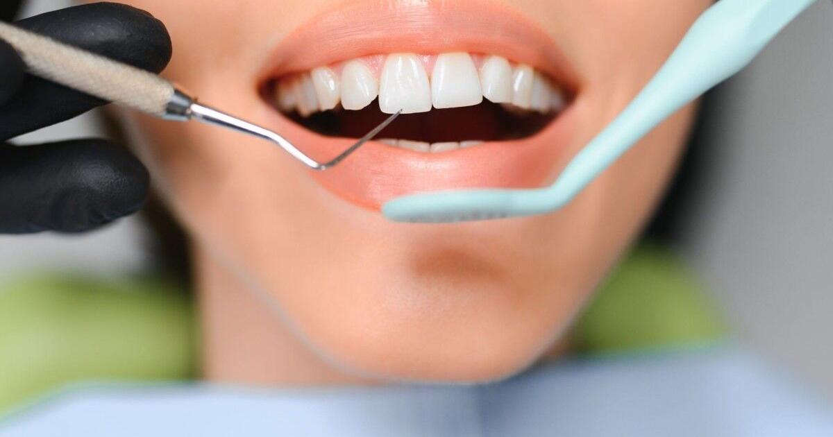 The Rise of Holistic Dentistry