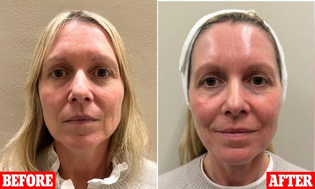 Non-Surgical Anti-Aging Solutions