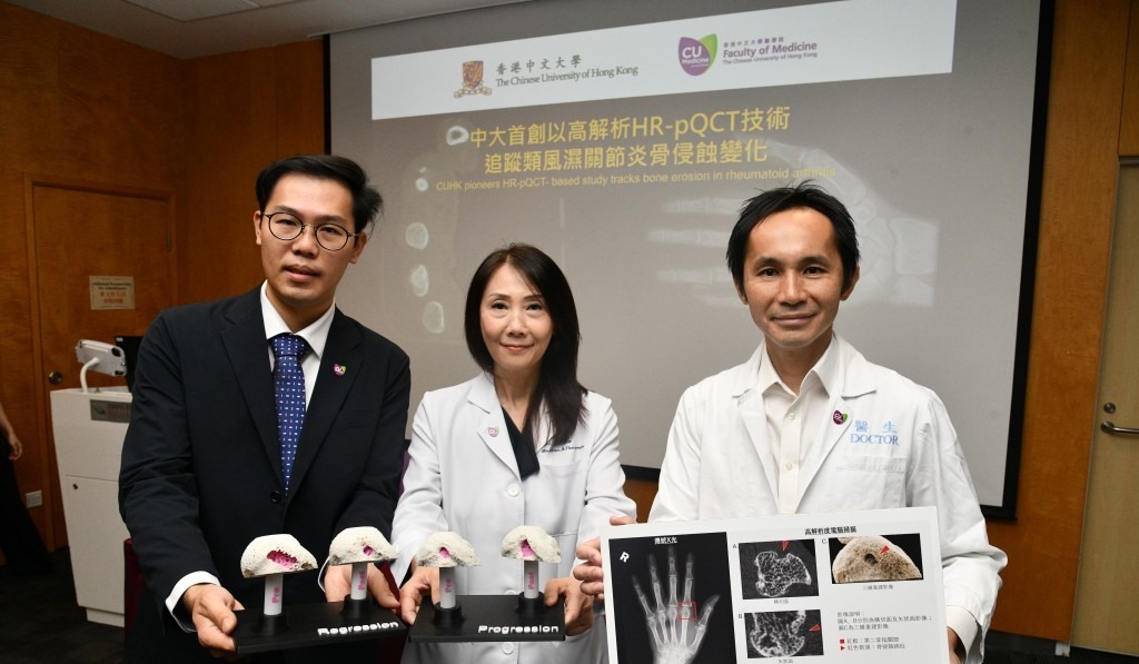 Earlier Arthritis Detection