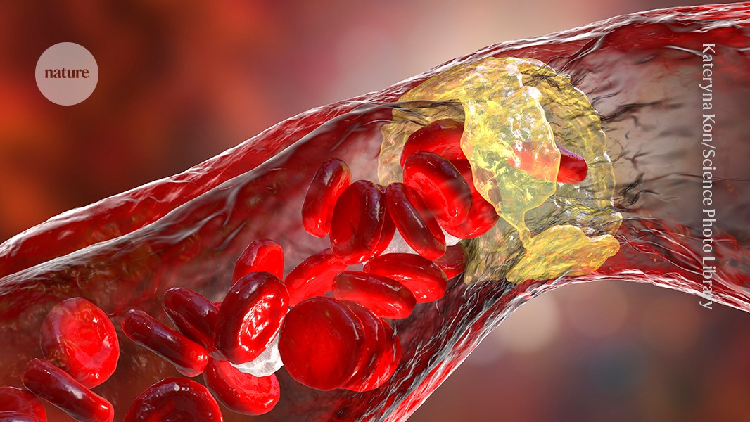 Gut Health Meets Heart Health