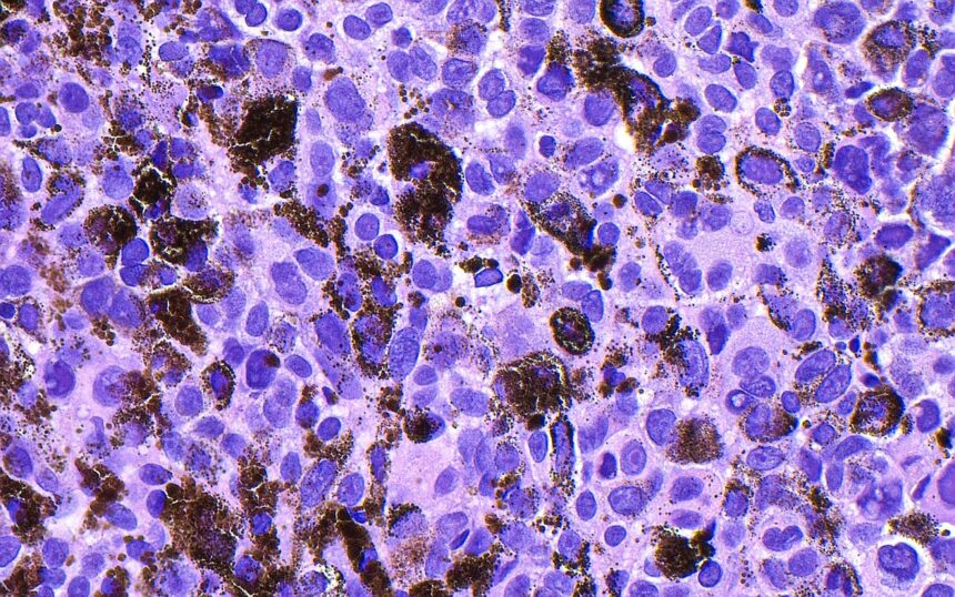 Personalized Cancer Breakthroughs